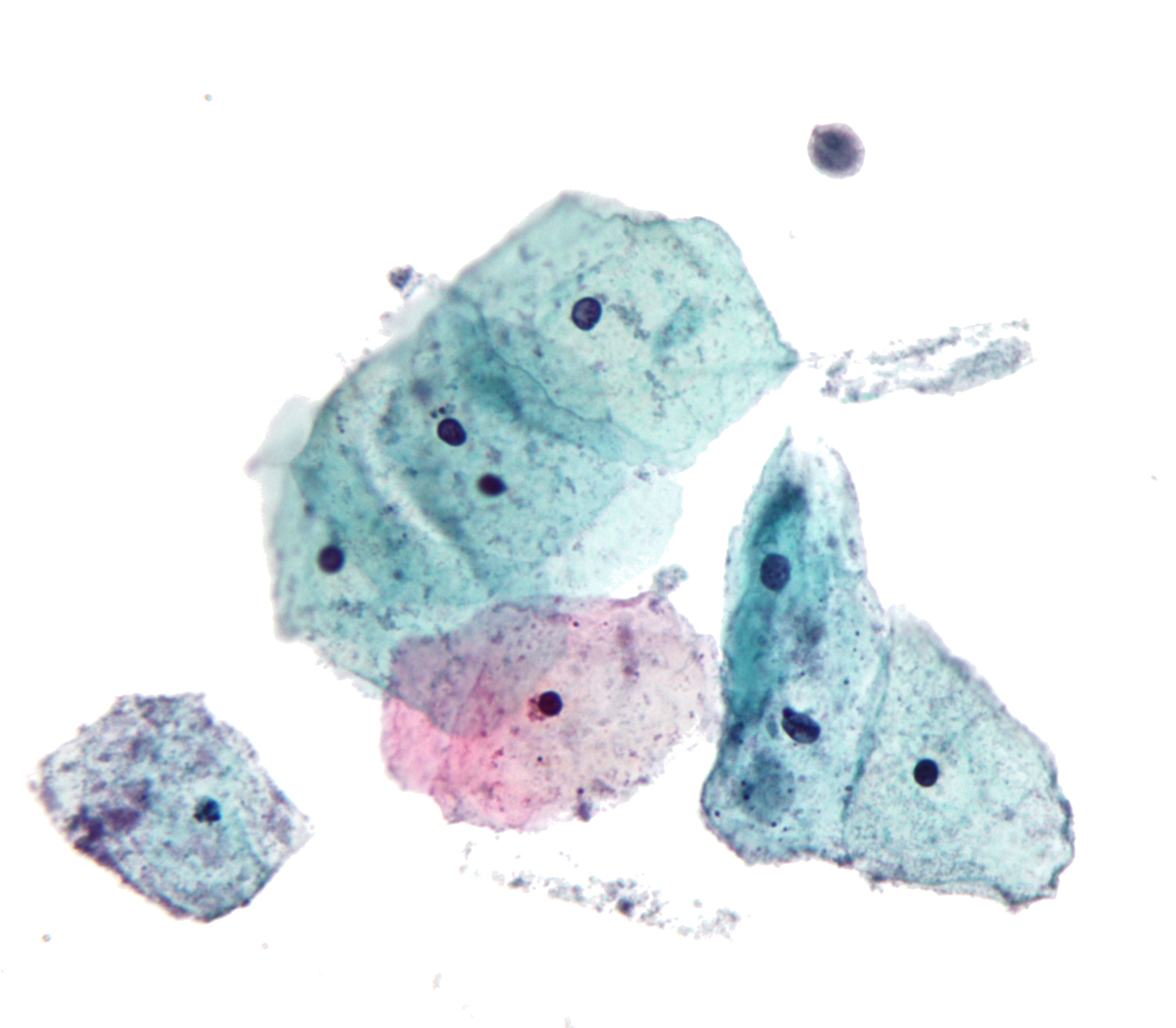 Most Common STDs