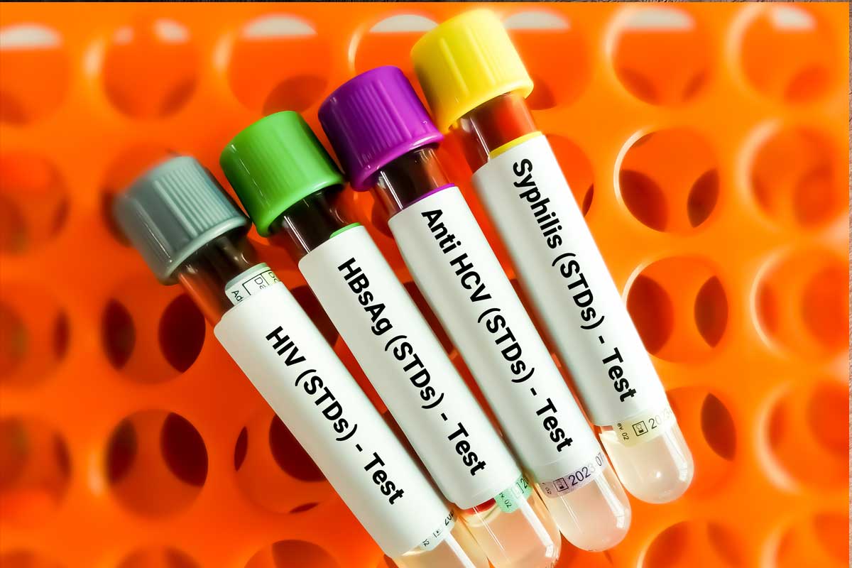 Types of STDs