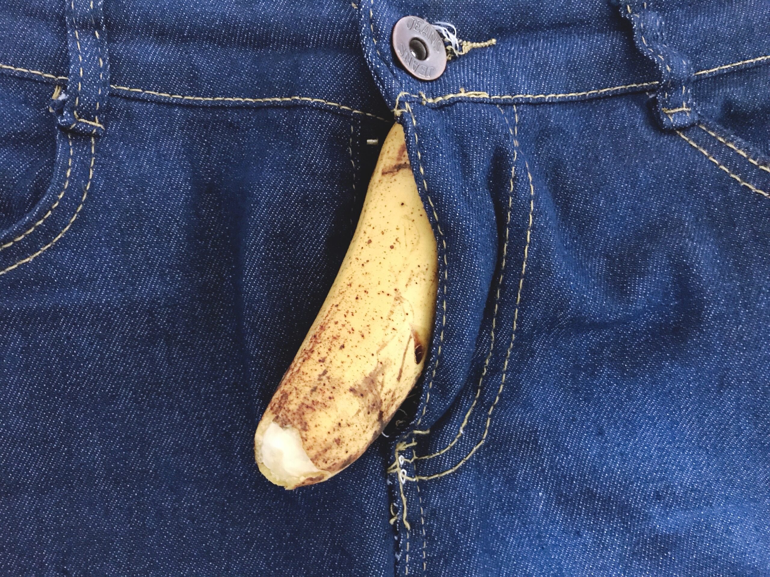 penile discharge
