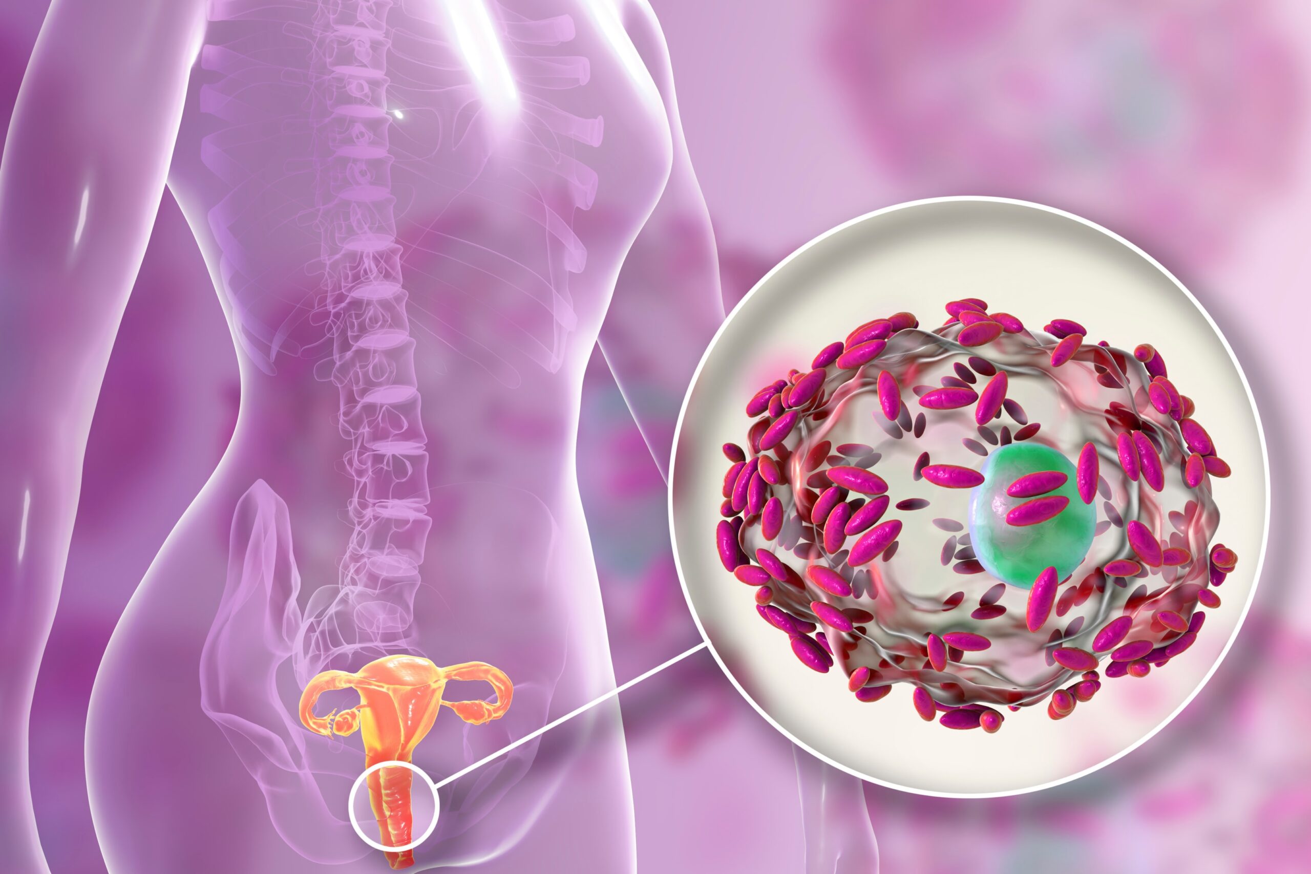 An illustration showing the vaginal microbiome and its relation to bacterial vaginosis.