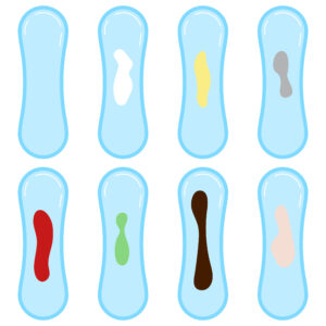 vaginal discharge colors